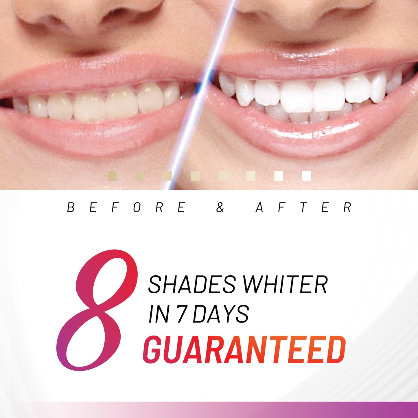 White Glo Accelerator Teeth Whitening Kit